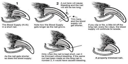 toenail diagram 1